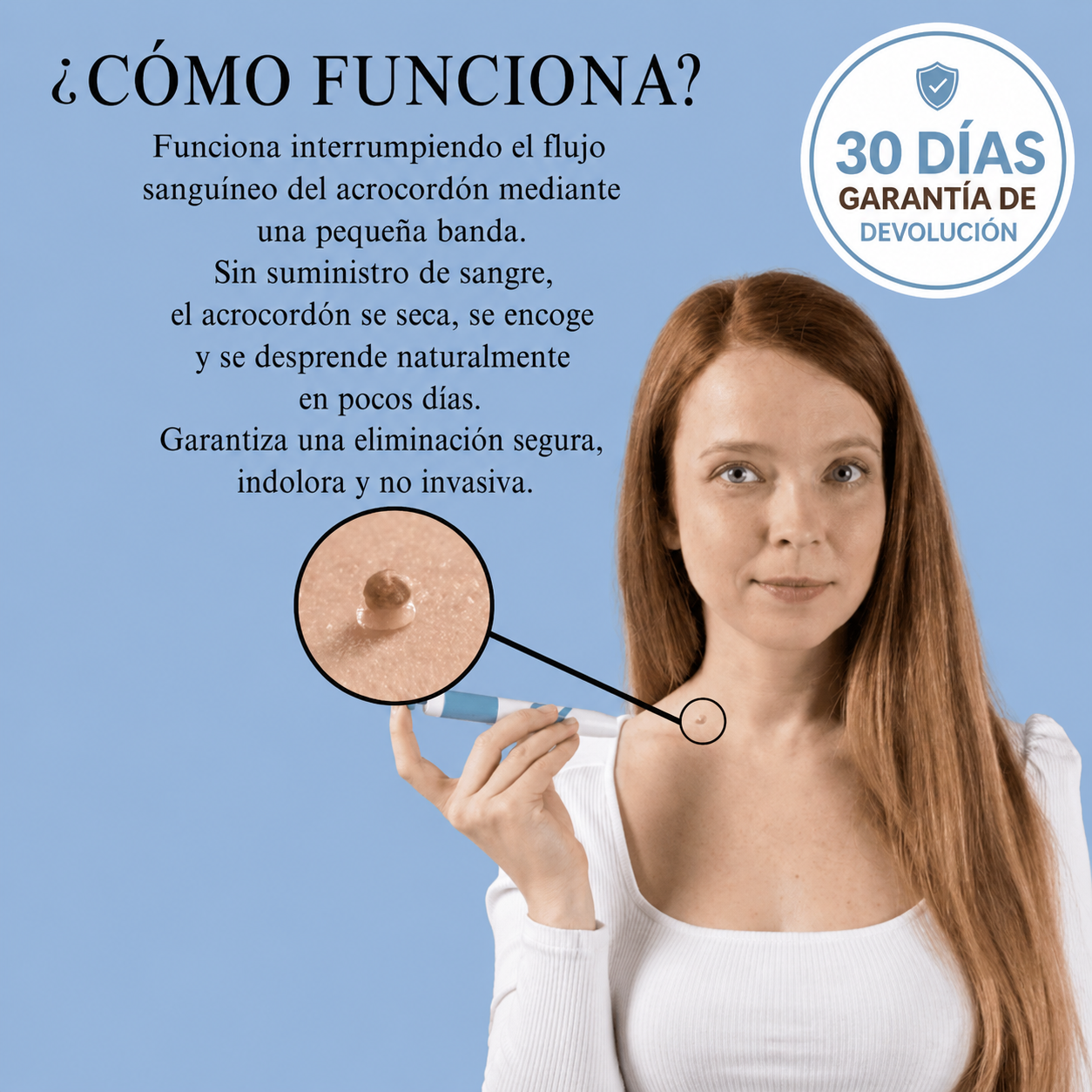 Dermly eliminador de Acrocordones con aplicador de bandas - Fácil y preciso