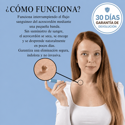 Dermly eliminador de Acrocordones con aplicador de bandas - Fácil y preciso